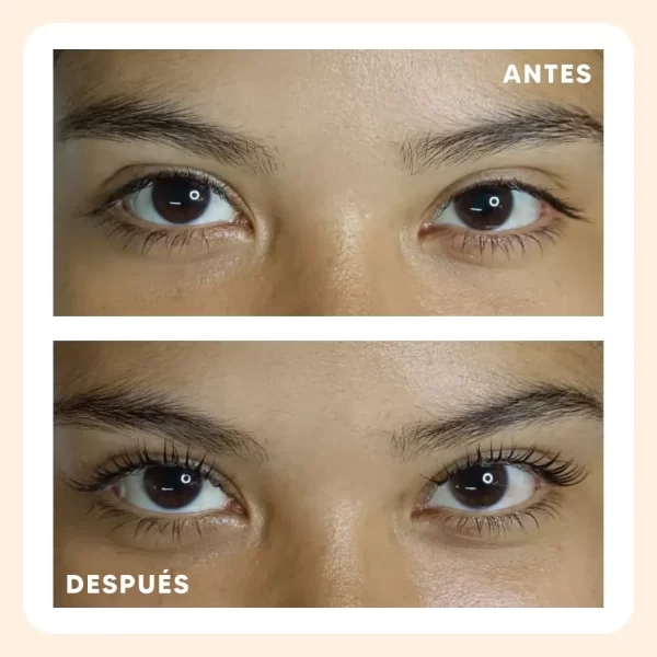 radiance_lifting_antes_despues_1