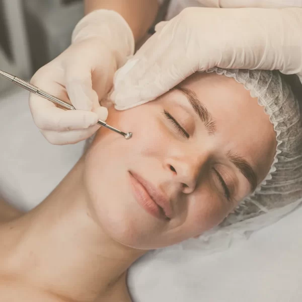 radiance_tratamiento_limpieza_facial_acneica
